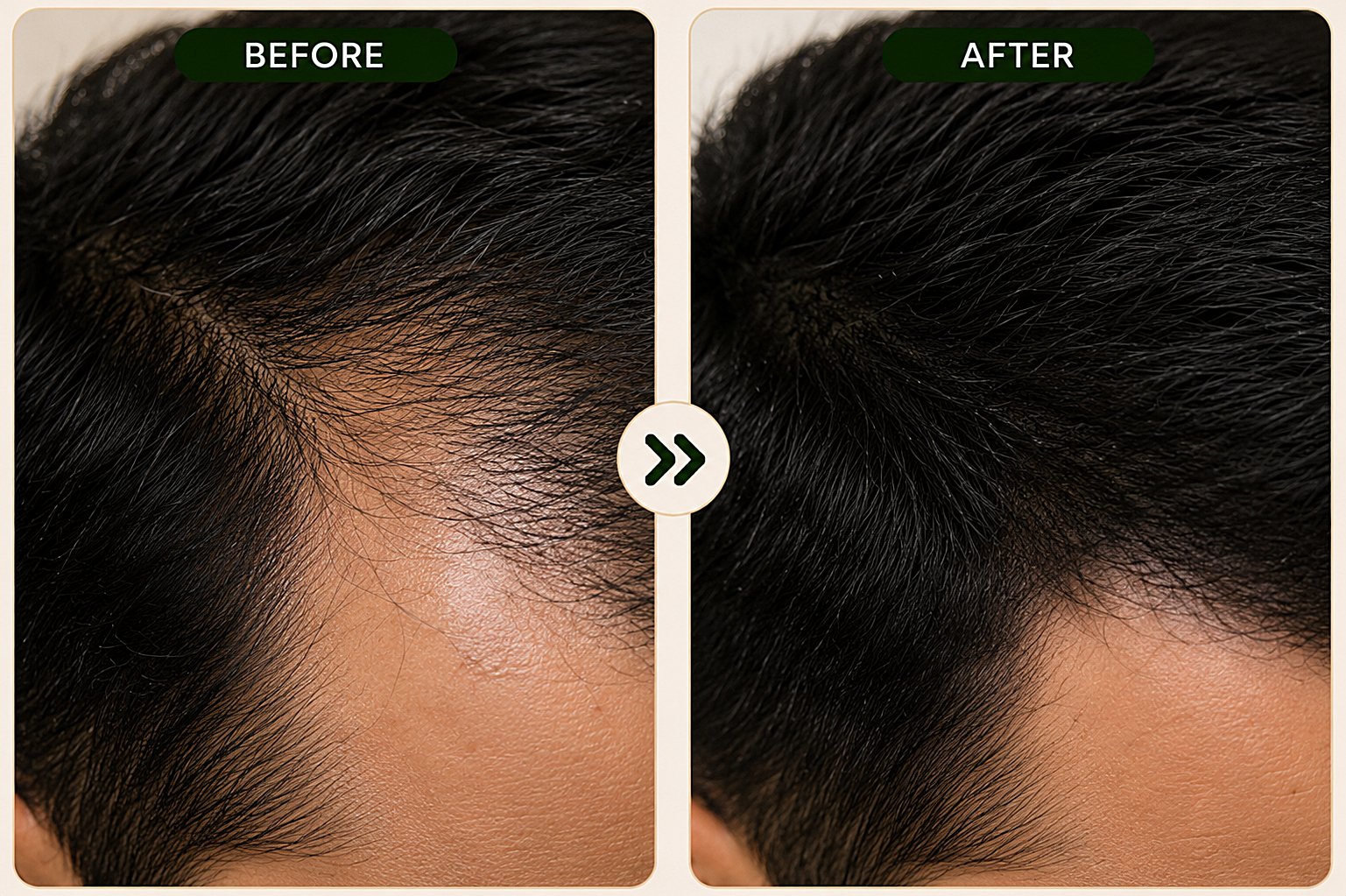 hair1